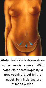 plastic surgery