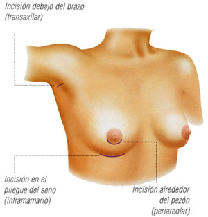 flastic surgery