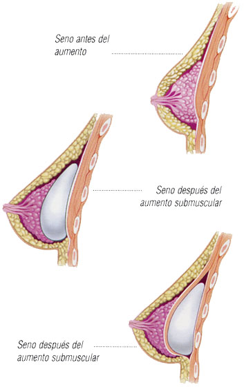 flastic surgery