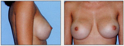 flastic surgery