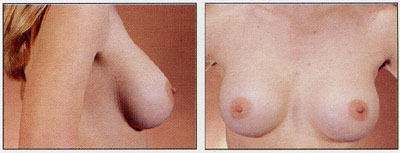 flastic surgery